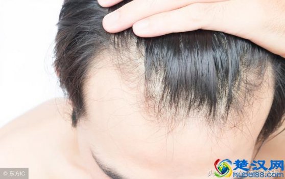  女性头发掉吃什么可以生发（多吃黑色的食物对防脱发有用吗）