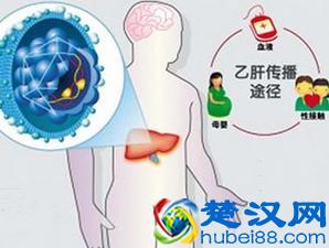  乙肝传播途径有哪些（乙肝传播途径有哪些呢）