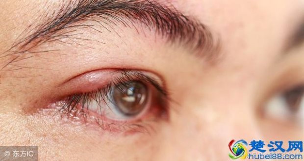  脸上长脂肪粒是怎么回事？其实是这5个原因导致的，解决就是这么简单