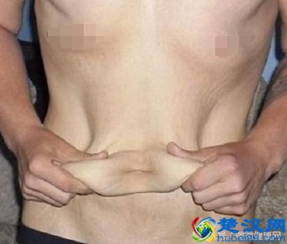  用什么方法减肥最快最有效（每天坚持这几个动作，不掉肉都不可能）