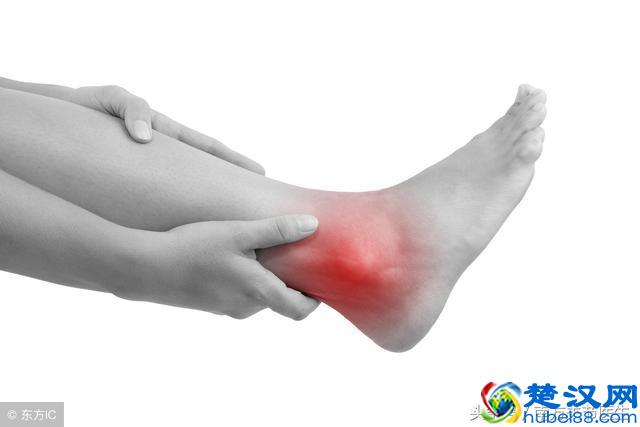脚踝扭伤肿了怎么办？快速消肿，不留后遗症